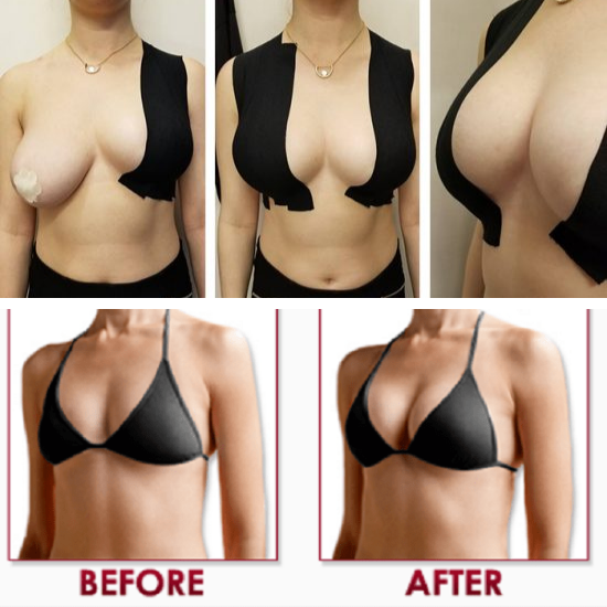 BOOB TAPE The Secret แถมฟรี‼️ ซิลิโคนปิดจุก เทปแปะกันโป๊ เทปผ้า เทปแปะอก เทปกาว เทปยกกระชับ