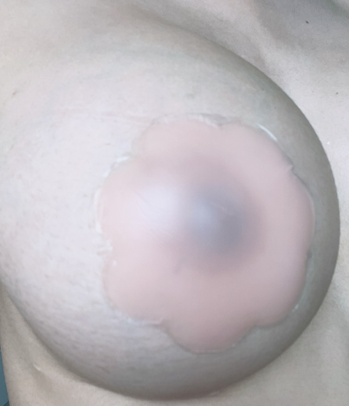 ซิลิโคนแปะจุก ที่ปิดหัวนม แปะหัวนม ปิดจุกนม เนื้อเจลทรงดอกไม้ขนาด 6.5cm และเนื้อด้านทรงวงกลมขนาด 8cm ซิลิโคนปิดจุก