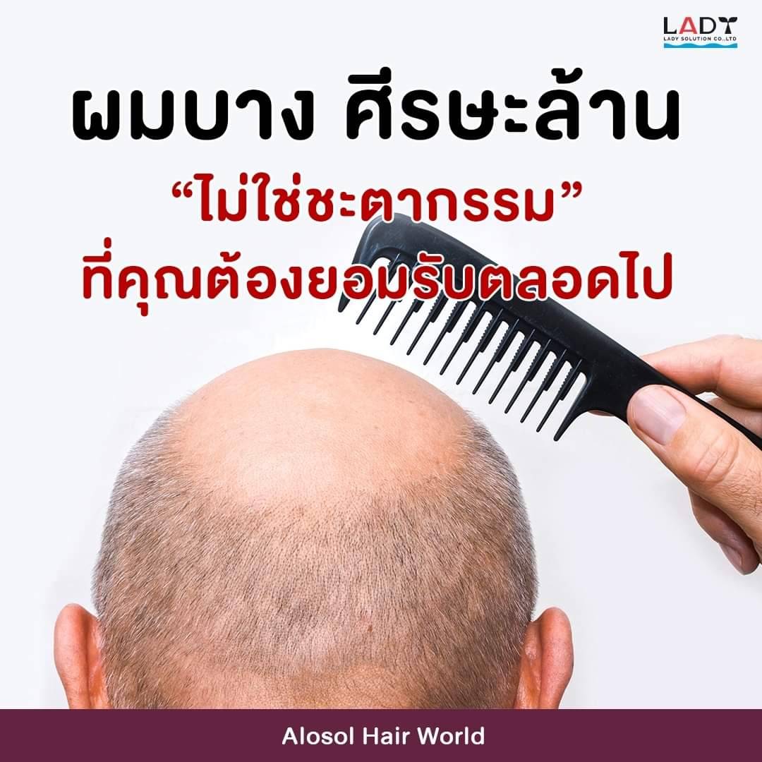 “ผมบางแล้วไง ก็แค่ปล่อยผมไว้ตลอด”