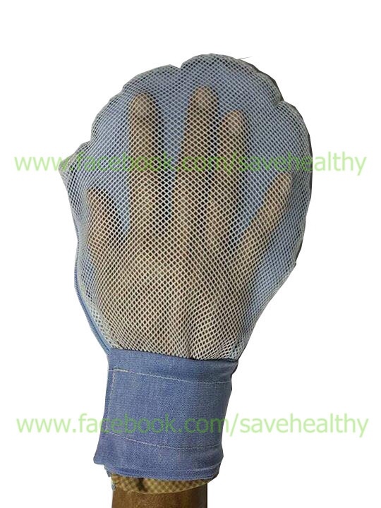 ถุงมือป้องกันการดึงสายน้ำเกลือ