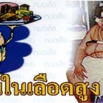 ไขมันในเลือดสูง